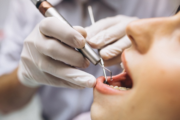 Igiene dentale_Studio Dentistico Brandolini