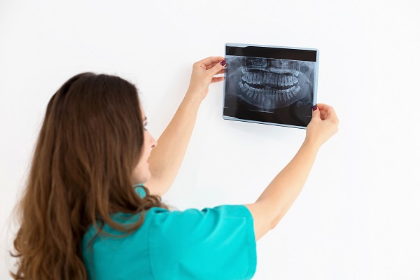 Esame diagnostico in preparazione di un intervento di ortognatodonzia.